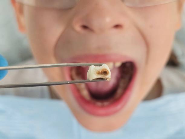 Best Broken Tooth Emergency  in Waynesburg, PA